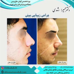 جراح بینی تبریز - دکتر رشدی