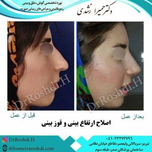 جراح بینی تبریز - دکتر حمیرا رشدی
