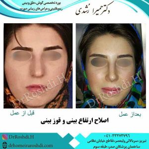 جراح بینی تبریز - دکتر رشدی