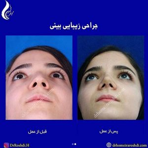 بهترین جراح بینی در تبریز