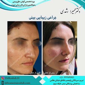 جراح بینی خوب در تبریز