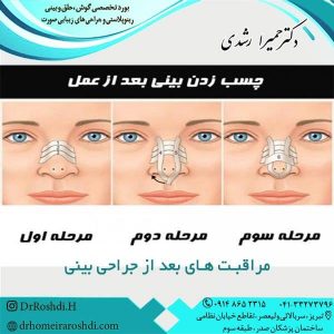 مراقبت های بعد از جراحی بینی - دکتر حمیرا رشدی
