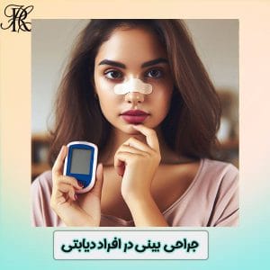 جراحی بینی در افراد دیابتی - دکتر حمیرا رشدی https://drhomeiraroshdi.com/