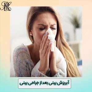 آبریزش بینی بعد از رینوپلاستی - https://drhomeiraroshdi.com/