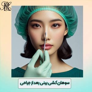 سوهانکشی بینی - دکتر حمیرا رشدی