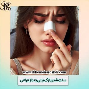سفت شدن نوک بینی بعد از جراحی - دکتر حمیرا رشدی