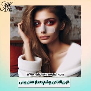 خون افتادن چشم بعد از عمل بینی - دکتر حمیرا رشدی