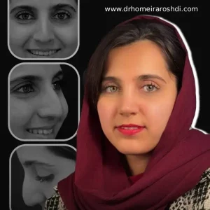 نمونه کارهای بهترین جراح بینی در تبریز _ دکتر حمیرا رشدی