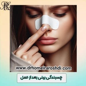 چسبندگی بینی بعد از عمل- دکتر حمیرا رشدی https://drhomeiraroshdi.com/