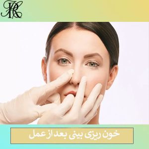 خون ریزی بینی بعد از عمل _ دکتر حمیرا رشدی