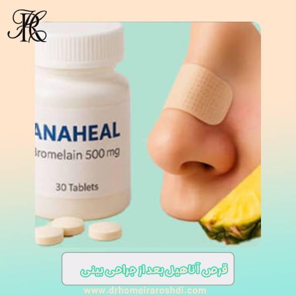 Anahil tablets after rhinoplasty