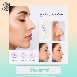 لیفت بینی با نخ