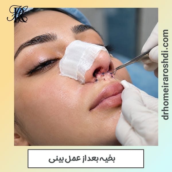 بخیه بعد از عمل بینی - دکتر حمیرا رشدی