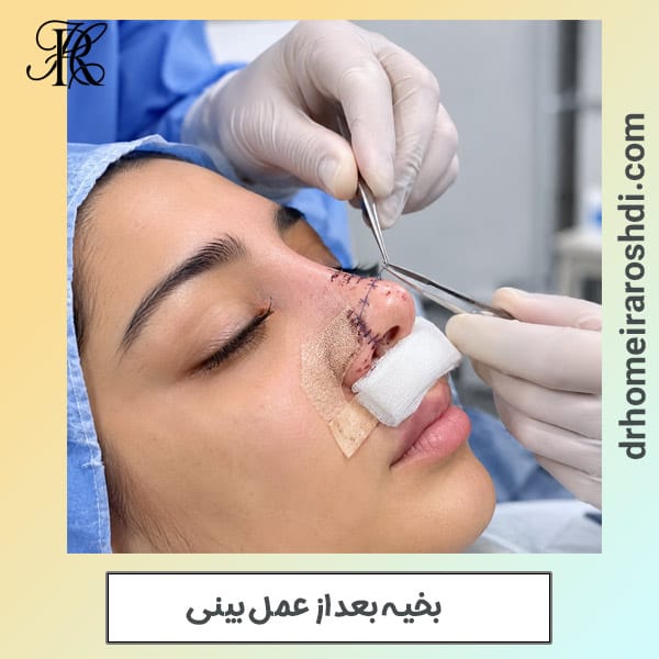 بخیه بعد از عمل بینی - دکتر رشدی