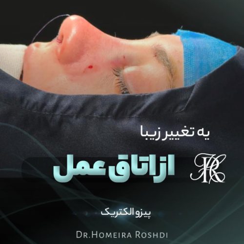 جراحی-بینی-393