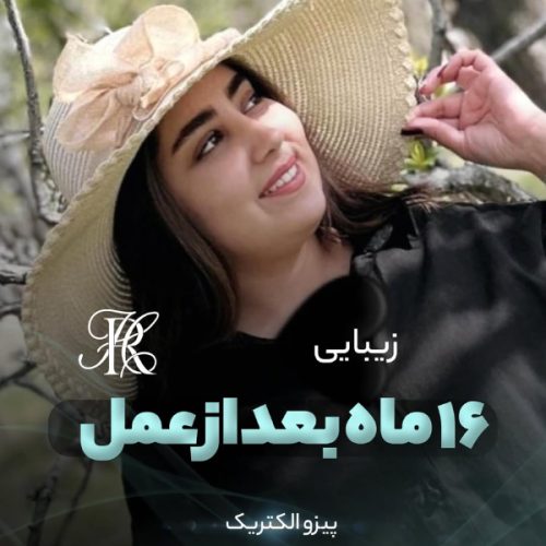 جراحی-بینی-394