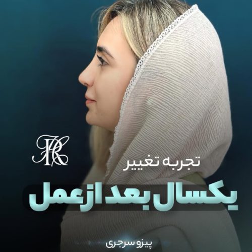 جراحی-بینی-396