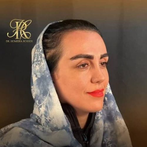 جراحی-بینی-407